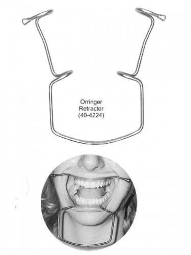 Dental Cheek, Lip Retractor Oringer image 0